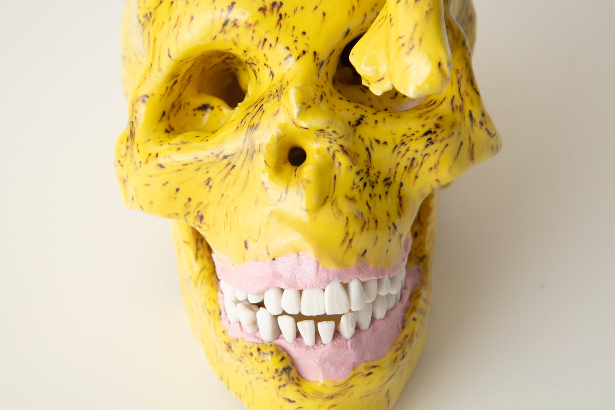 Keith Simpson "Banana Rocking Pot with Skulls" I